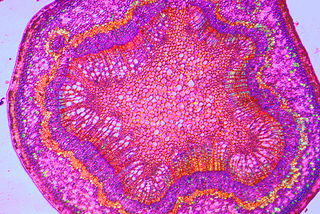 According to the nation's top scientists, the deadly ST-p5 virus (right) causes something bad to happen somewhere in the human head.
